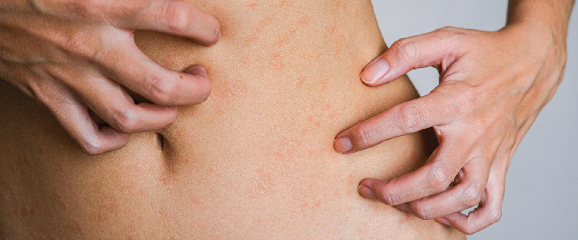 Najczęściej występujące choroby skóry (dermatozy) i ich objawy